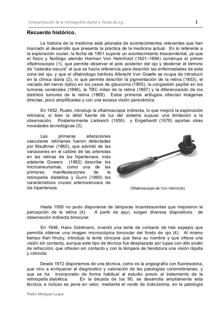 diabetes por microangiopatía intrarretiniana