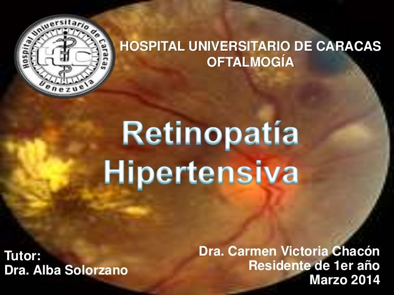 Retinopatía hipertensiva maligna