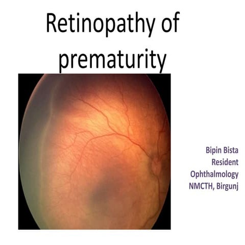 Retinopathy of prematurity
