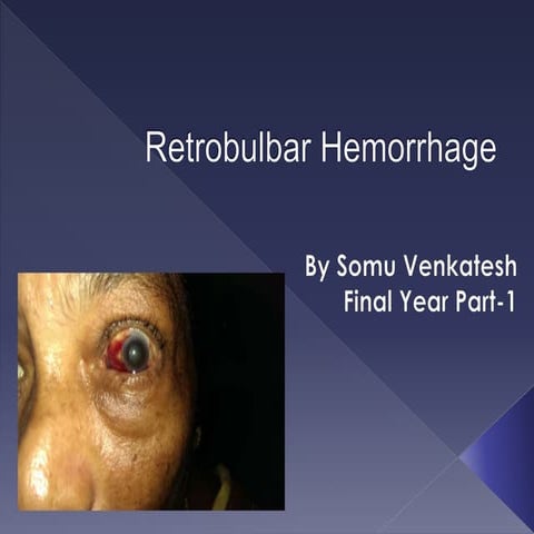 Retrobulbar hemorrhage by Somu Venkatesh