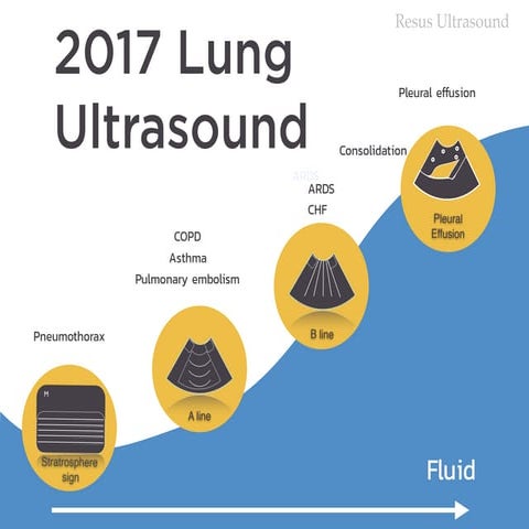 Review lung ultrasound