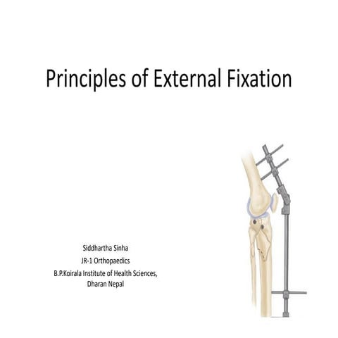 Principles of external fixation