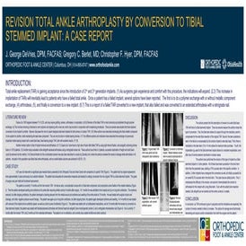 Revision Total Ankle Arthroplasty to Tibial Stemmed Implant: A Case Report