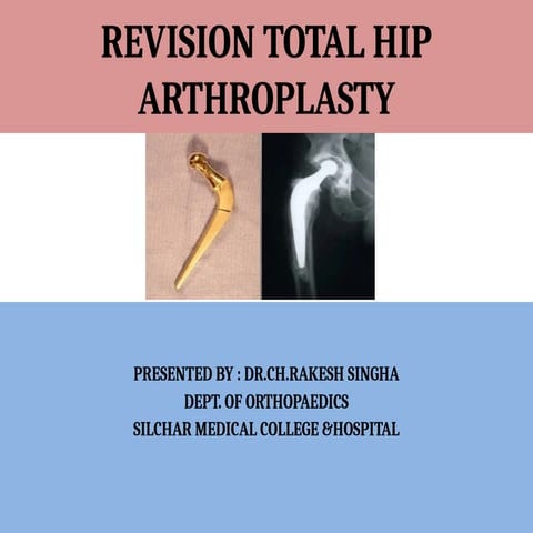 REVISION THA Dr Rakesh Singha Ortho.pptx