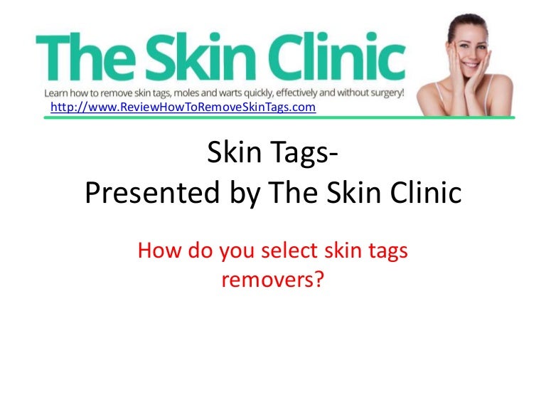 Revitol Skin Tag Removal Review What You Should Know About Skin Tags