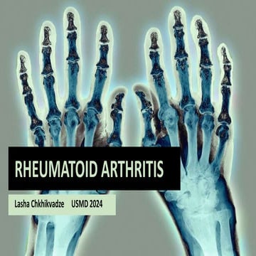 Rheumathoid arthritis