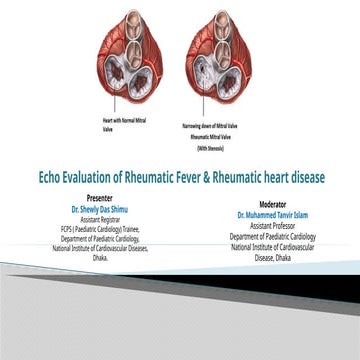 Echocardiographic screening for rheumatic heart disease | PPTX