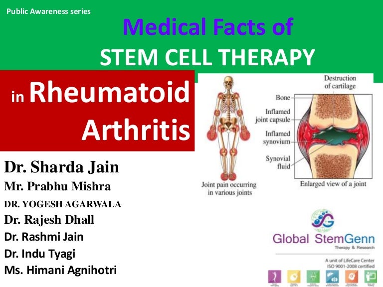 Medical Facts of STEM CELL THERAPY in Rheumatoid Arthritis Medical Facts of STEM CELL THERAPY in Rheumatoid Arthritis
