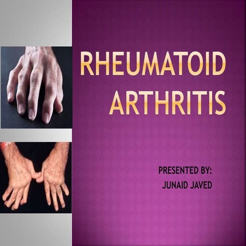 rheumatoid arthritis.pptx for MBBS student | PPTX