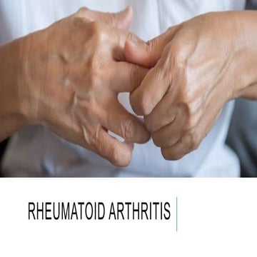 Rheumatoid arthritis