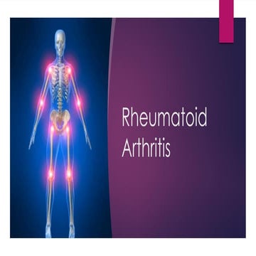 Rheumatoid arthritis- diagnosis and treatment | PDF