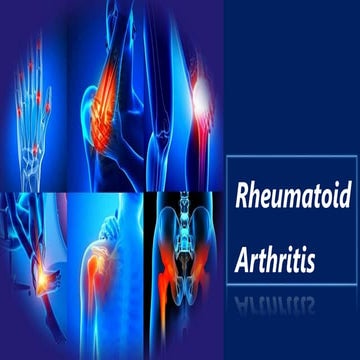 Rheumatoid arthritis.pptx