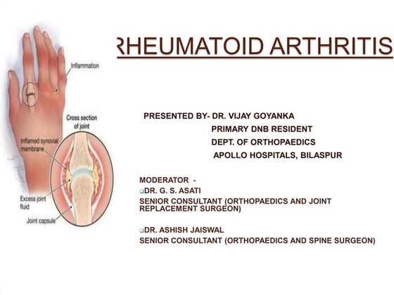 SERONEGATIVE ARTHERITIS in details presentation.pptx
