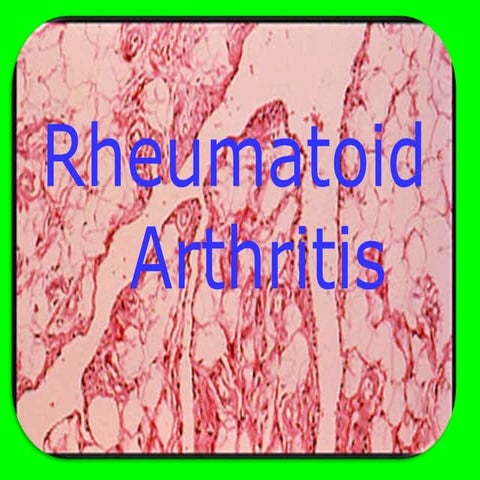 Rheumatoid arthritis - Musculoskeletal disorders.ppt
