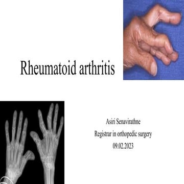 Comprehensive Overview of Rheumatoid Arthritis: Pathogenesis, Diagnosis ...