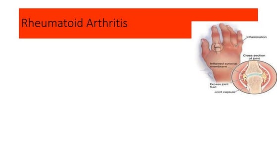 Diseases of Autonomic Nervous System I Autonomic Nervous System II ...