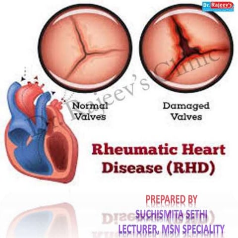 Rheumatoid heart disease