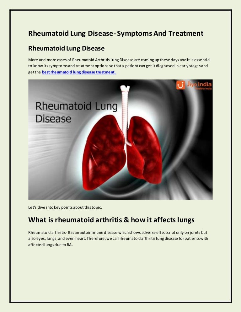 Rheumatoid Lung Disease Treatment