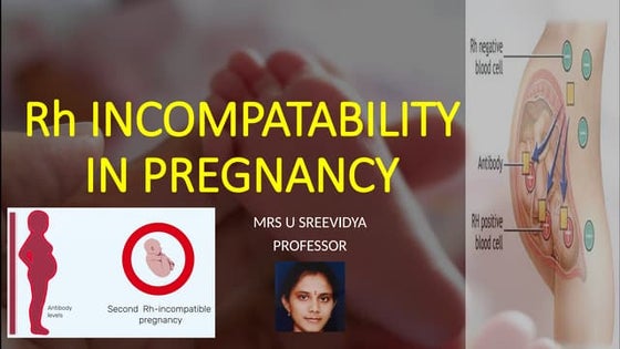 Rh Incompatibility I Hemolytic Disease of the Newborn | PPT