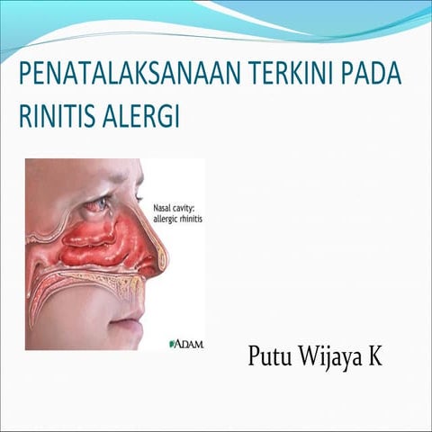 Rhinitis alergi 