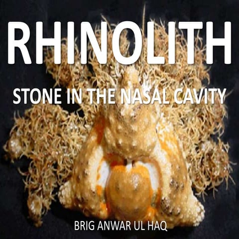 Rhinolith