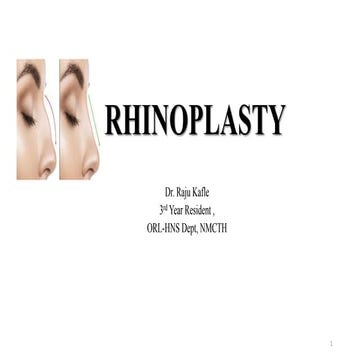 Rhinoplasty dr.  rk