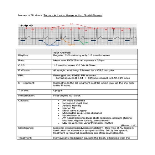 ATRIOVENTRICULAR BLOCKS.pptx