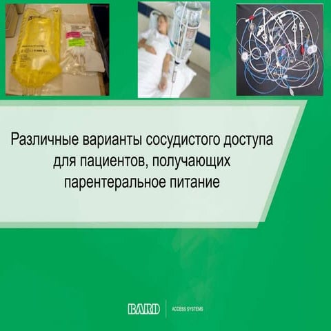 Различные варианты сосудистого доступа для пациентов, получающих прентерально...