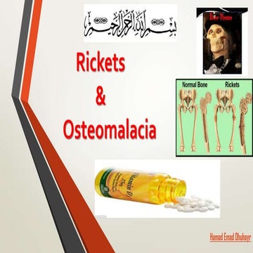 Imaging in rickets | PPTX