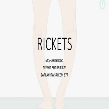 Rickets | PPTX