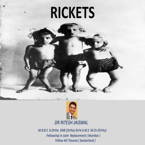 RICKETS | PPTX
