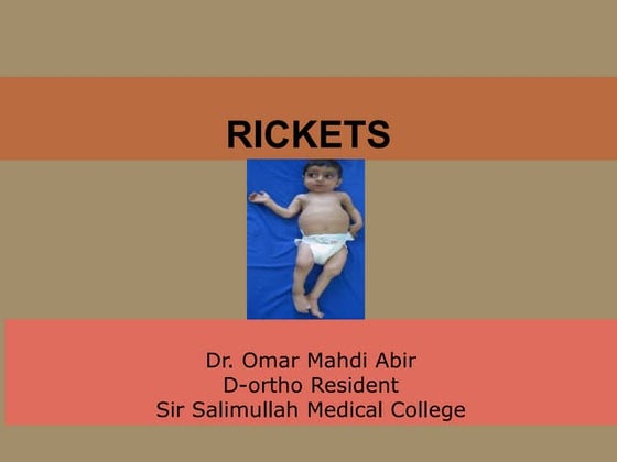 RICKETS : introduction, clinical features, Diagnosis, PT mangement | PPT