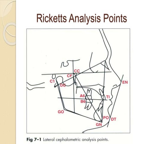 Ricketts analysis
