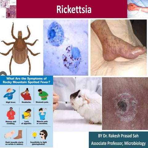 Rickettsia by Dr. Rakesh Prasad Sah.pptx