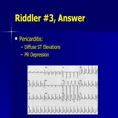 Riddler Q3 | PPT