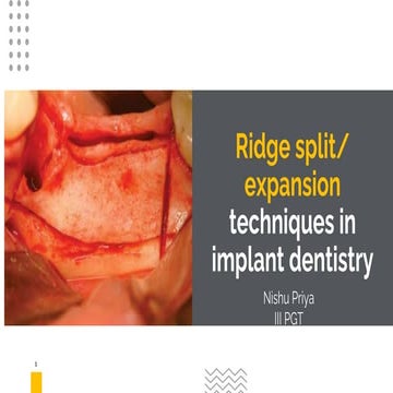 Ridge split in implantology