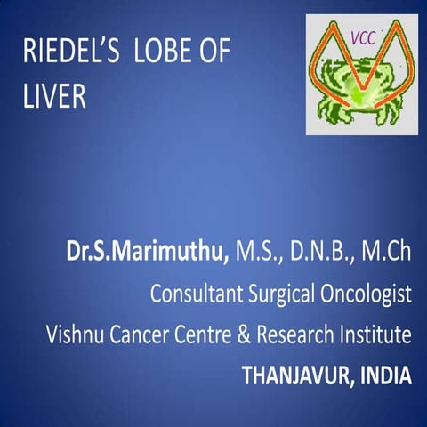 Riedel’s lobe of liver | PPTX