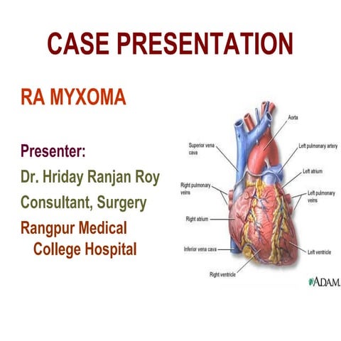 Right Atrial Myxoma - A Case Report