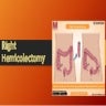 right-hemicolectomy-pptx
