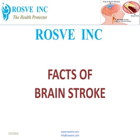 RIHMS Brain Stroke