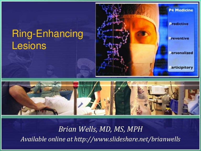 Ring Enhancing Lesions