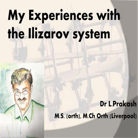 My Experiences with Ilizarov system