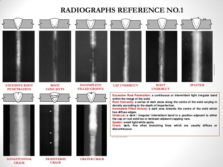 Radiographic interpretation