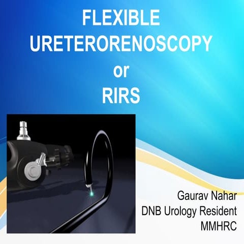 Flexible Uretero-renoscopy or RIRS