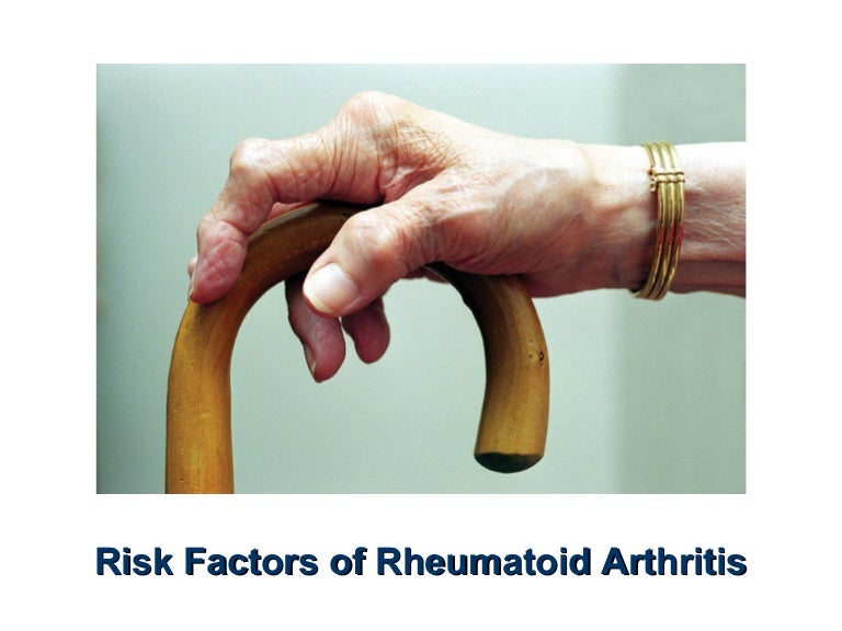 Risk Factors of Rheumatoid Arthritis