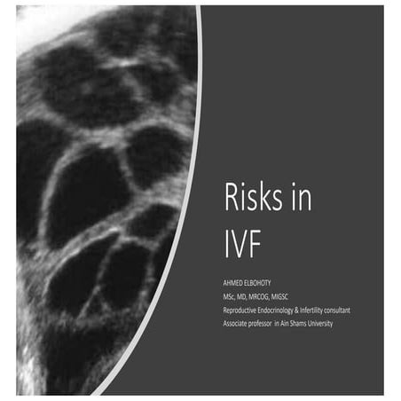 Risks of ivf | PDF