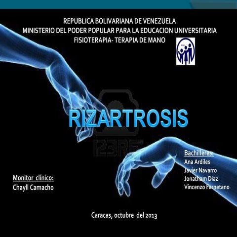 Rizartrosis