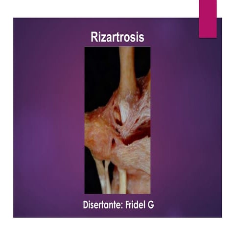 rizartrosis.pdf