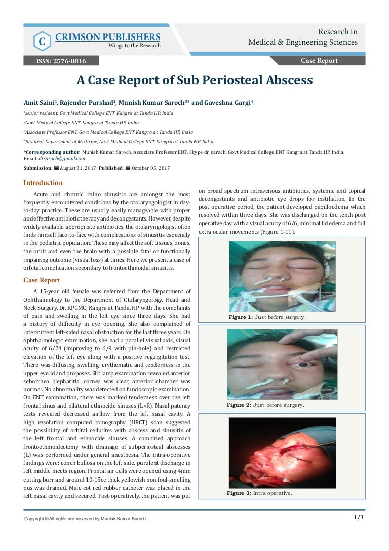 A Case Report of Sub Periosteal Abscess Crimson Publishers