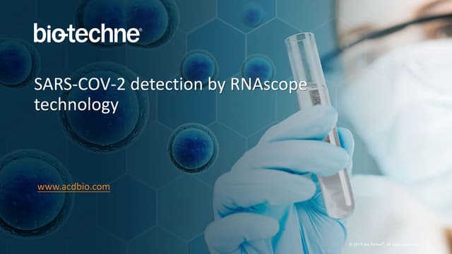 SARS-COV-2 detection by RNAscope technology